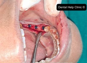 Dental Help Clinic Work 6