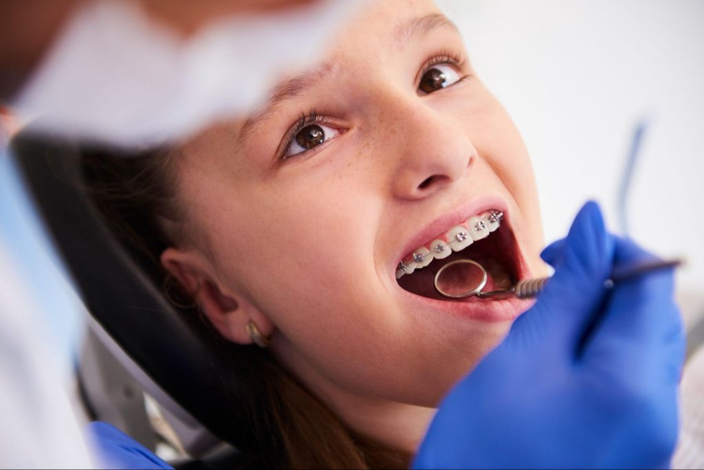 Dental Braces 3.jpg